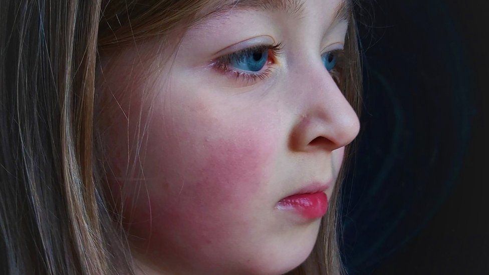 Long Covid: NHS legal action launched by family of girl