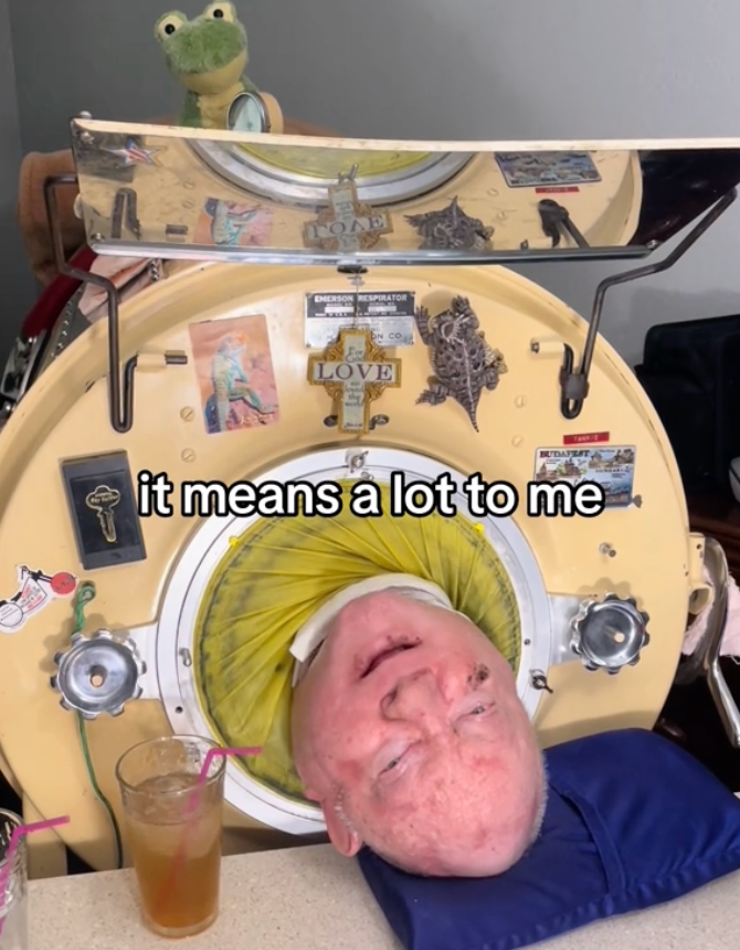 People left wondering if man who lives inside iron lung machine can actually get out