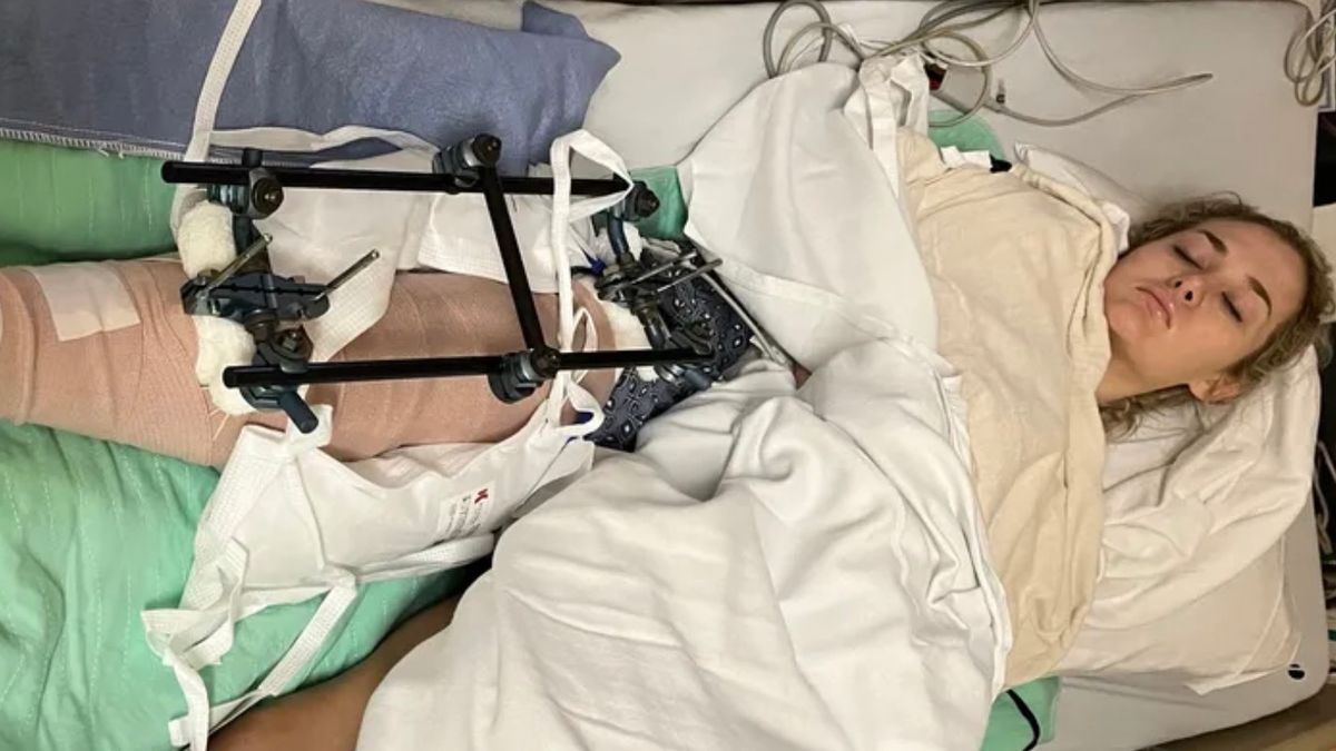 Woman's leg almost severed after hitting tree at 60mph in horror skiing accident