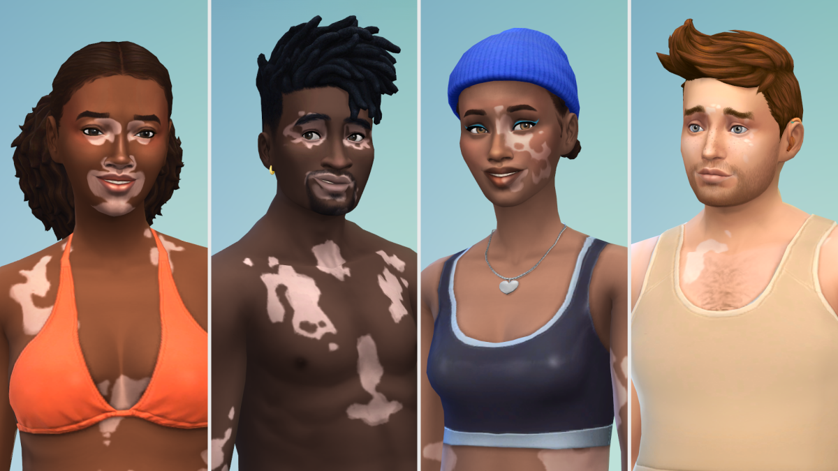 'The Sims 4' adds vitiligo in free update
