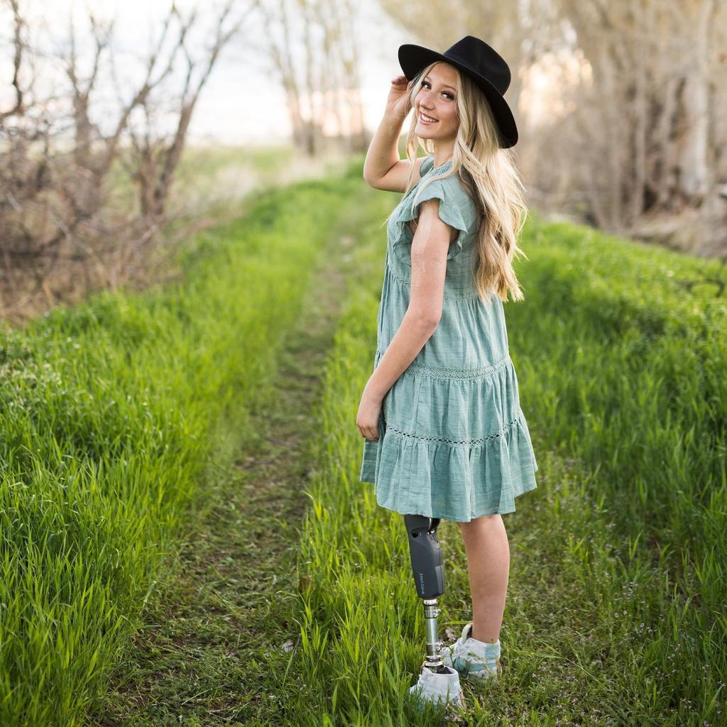 Idaho teen describes how hanging from power line with broken leg for an hour saved her life after car crash: ‘Happened so quickly’