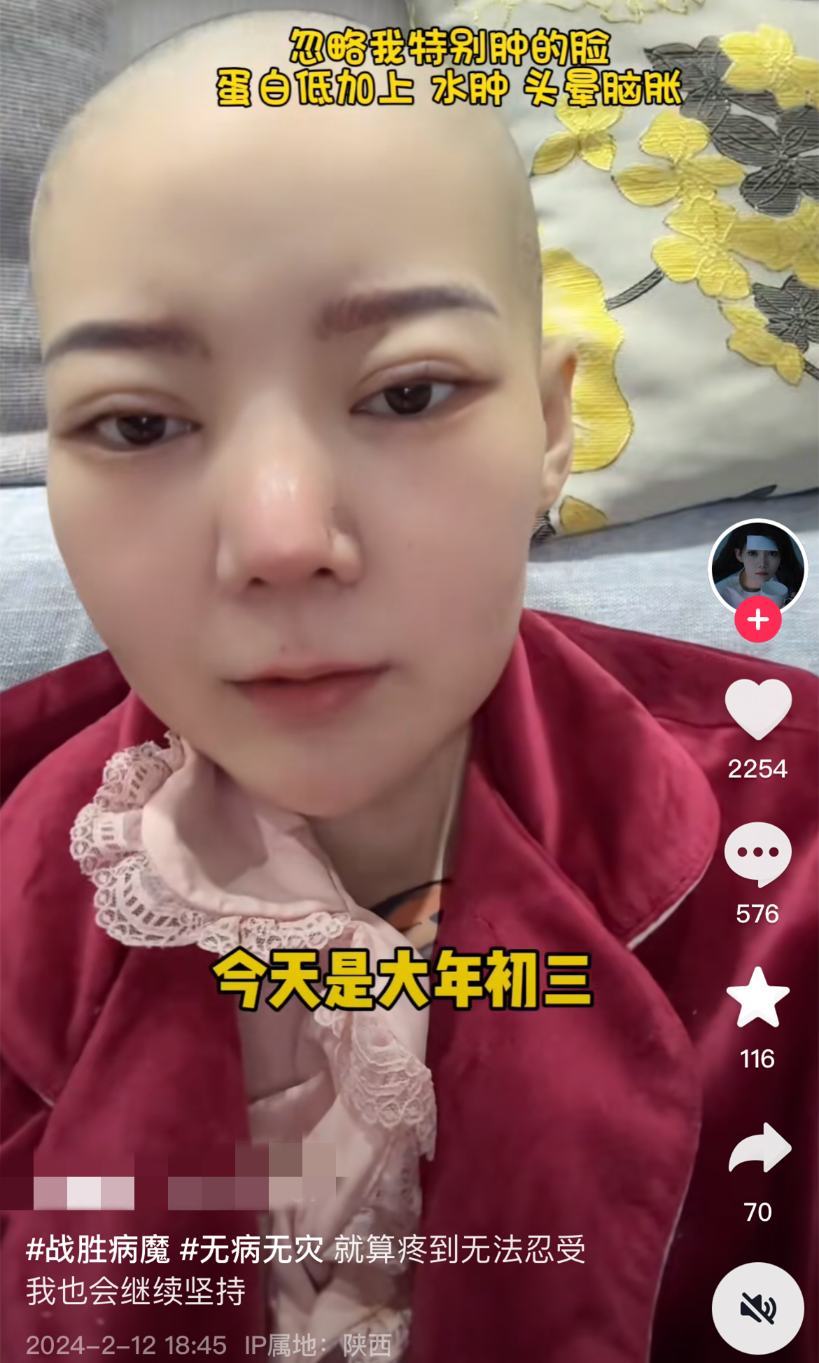 28岁网红“菲菲公主”去世，确诊前后判若两人