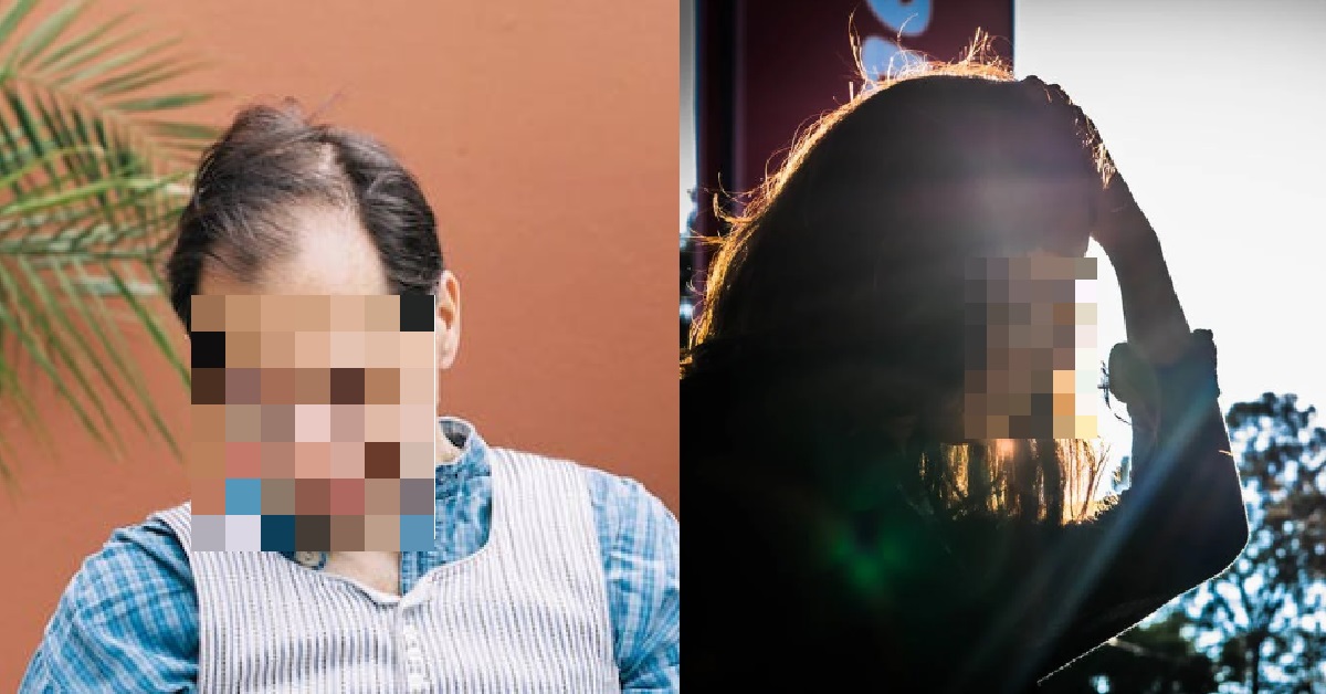 GIRL LOSING ATTRACTION TO BF, WHO IS BALDING, HAD BAD BREATH & A FLAKY FACE