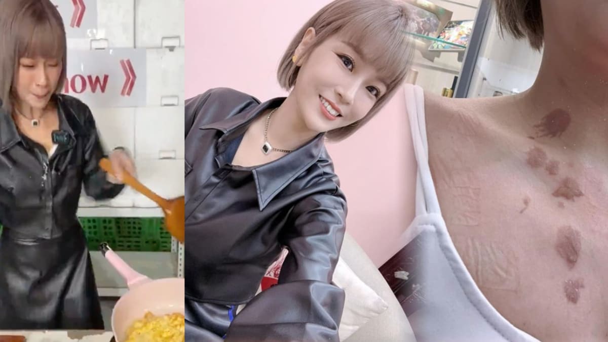 Taiwanese Live Streamer Suffers Burns After Hot Oil Splatters On Her During Cooking Demo
