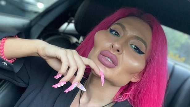 'I've got 'world's biggest cheeks' - people can't believe what I looked like before surgery'