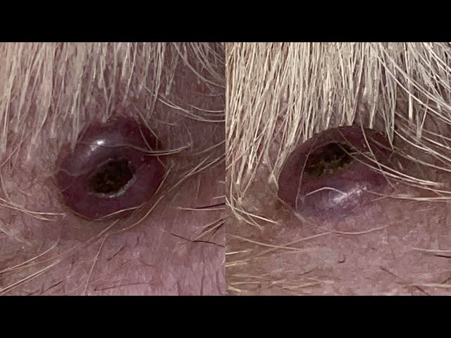 Removing A Huge Botfly Maggot From Dog's Chin (Part 9)