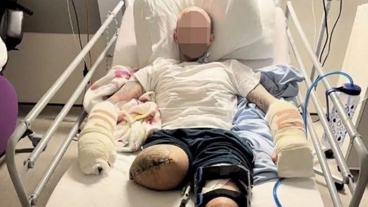 Man who lost a leg after terrifying machete home invasion faces jail over 140mph police chase