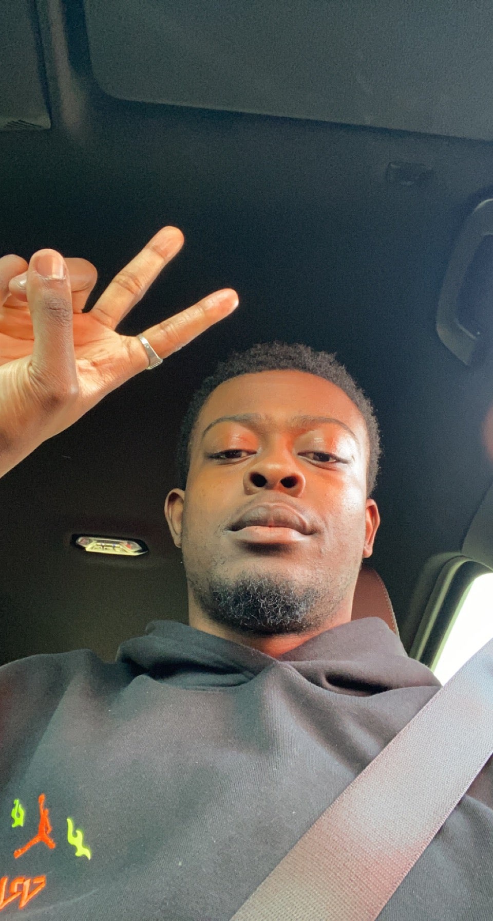 Man left with eye protruding from head after noticing small bruise on his face