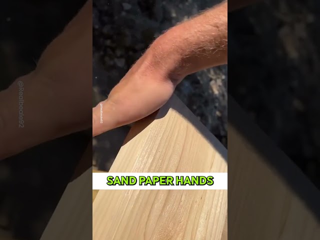 Man Has Hands As Rough As Sandpaper 😲