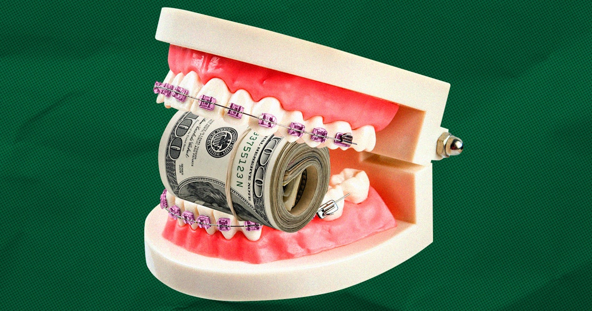 I Knew Braces Were Expensive But Damn