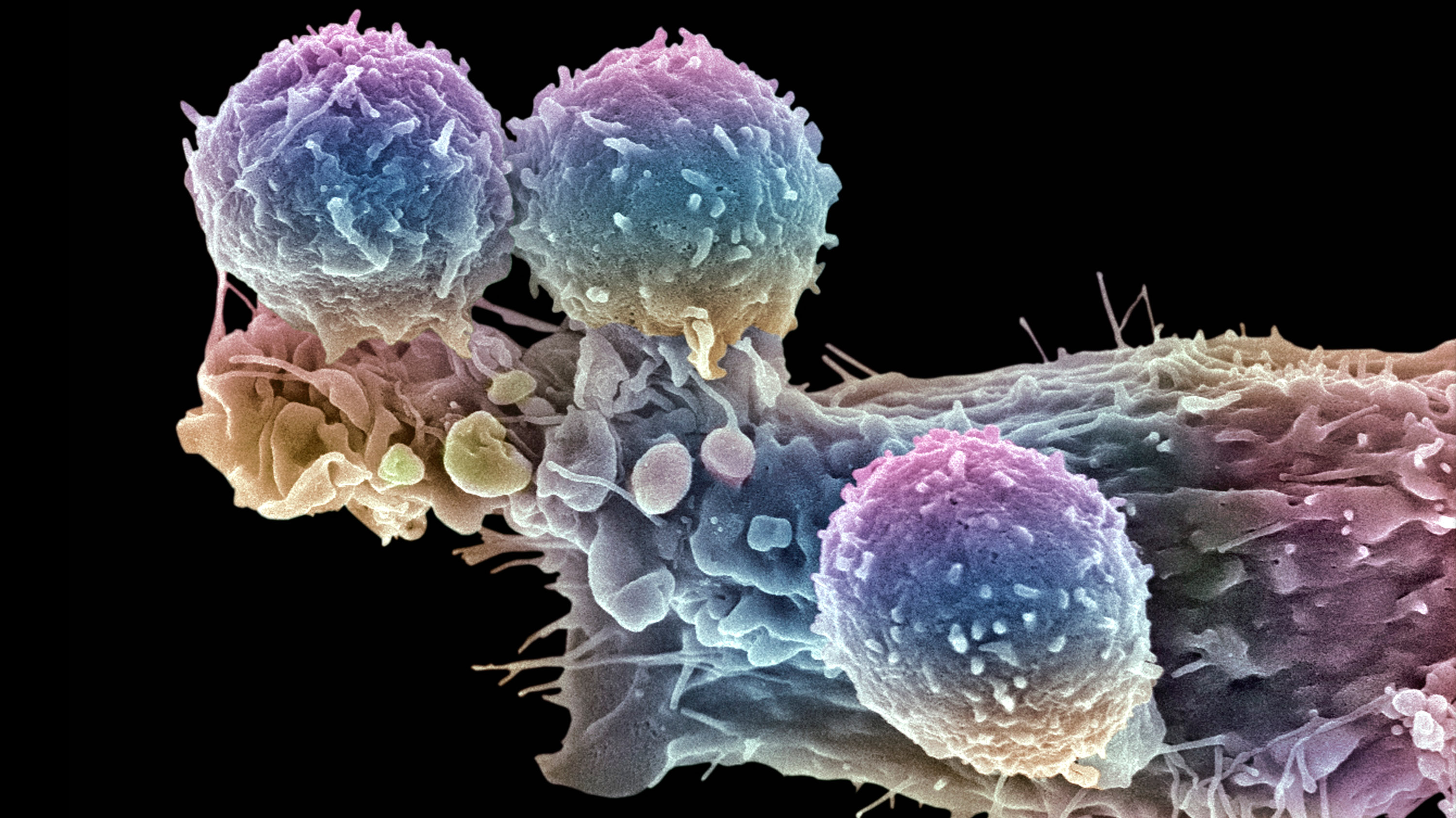The effort to make a breakthrough cancer therapy cheaper
