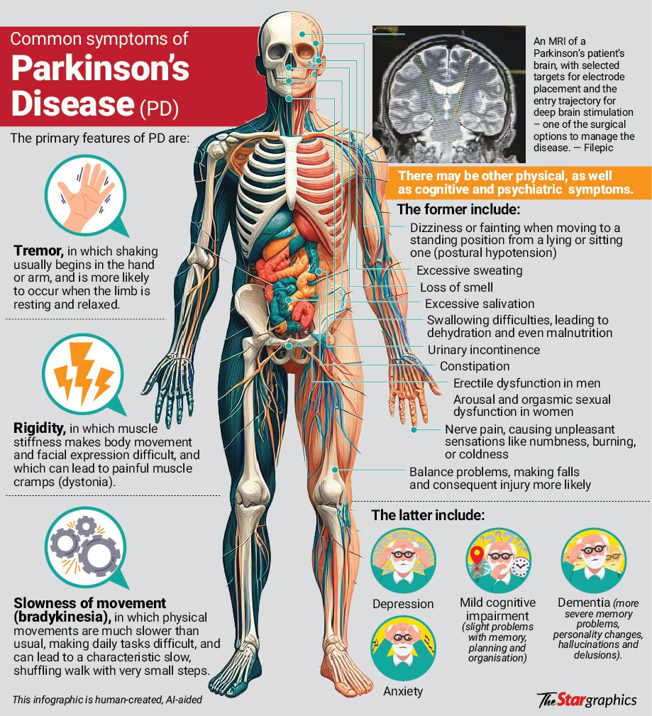 Parkinson’s disease: Manageable for many years with drugs and supportive therapy