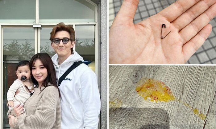 Taiwanese stars Sharon Hsu and Edison Wang guilt-ridden after baby vomits out safety pin and blood