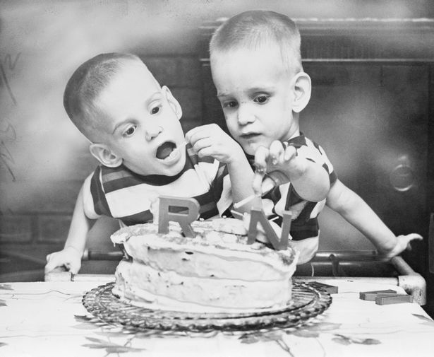 Inside life of longest-living conjoined twins who travelled with circus from just three years old