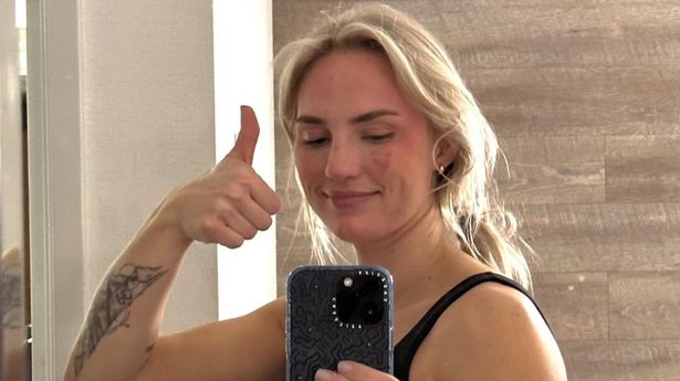 Influencer flaunts natural belly to show 'perfection isn't real'