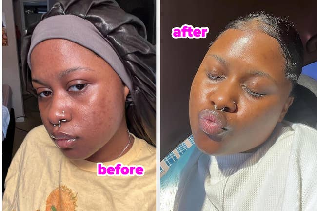30 Skincare Products You’ll Never Go A Day Without After Trying ‘Em Out