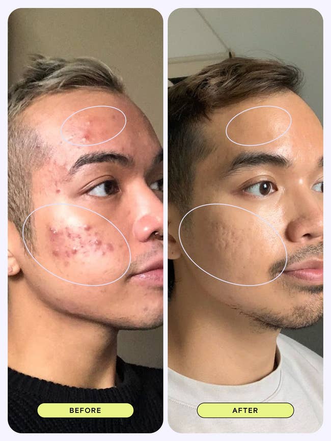 No It's Not Witchcraft, These 28 Korean Beauty Products Just Work Really Well