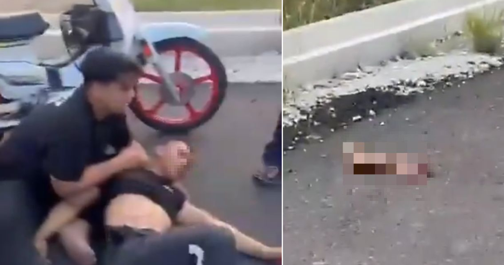 Video of gruesome accident went viral! Teen's severed leg flew after collision with another bike!