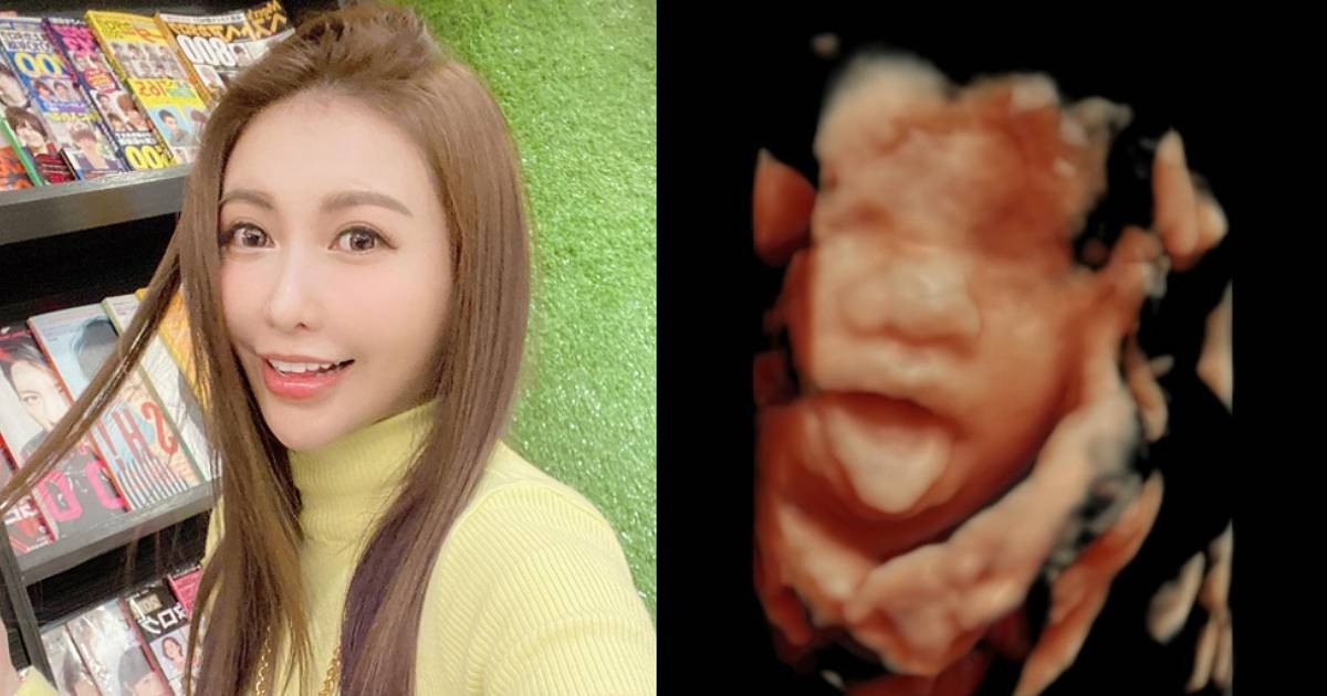 Linda Chien appears 4 years after Show Lo's scandal to announce pregnancy