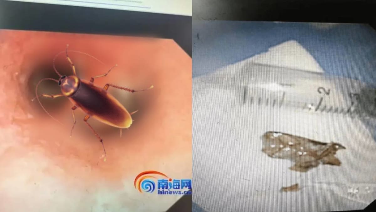 Man Develops Bad Breath After A Cockroach Crawls Into His Mouth And Gets Stuck In His Throat When He Was Sleeping