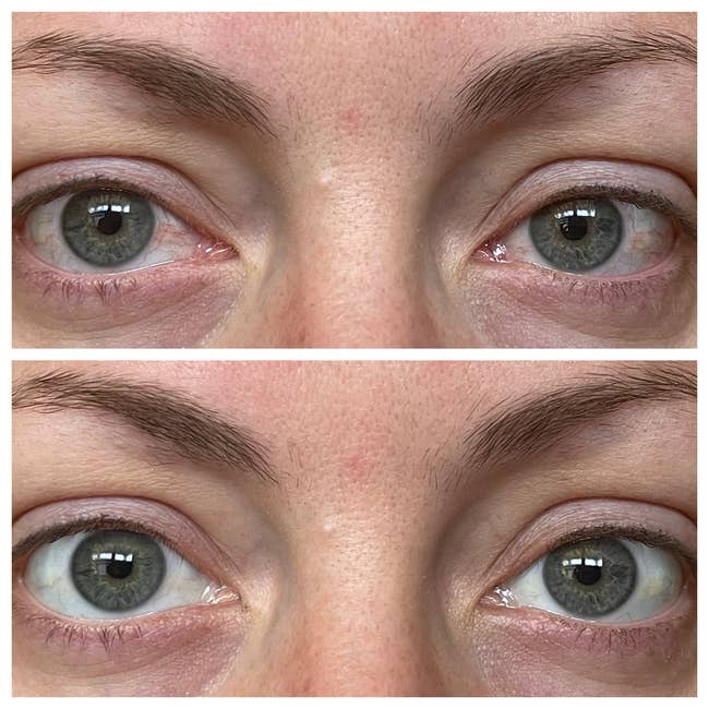 41 Things To Help You Realize That Some Of Your Body-Related Problems Have Legit Solutions