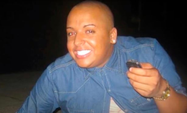 Controversial 'Lip King' Jordan Parke unrecognisable in photos before 50 procedures
