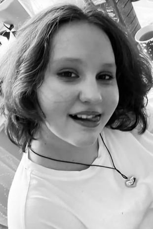 Schoolgirl, 12, dies after being attacked by pack of stray dogs that tore off her scalp