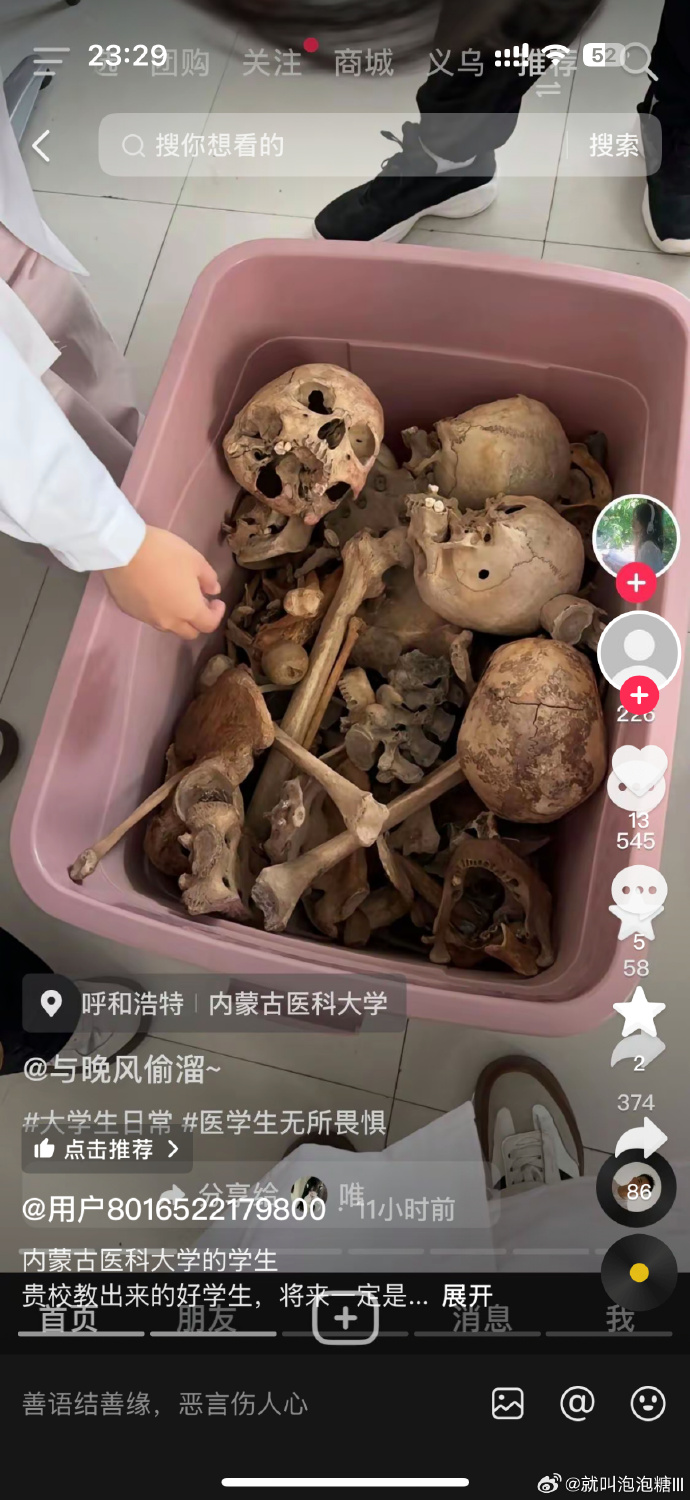 内蒙医大学生晒与大体老师遗骨「无惧合影」引议