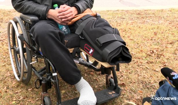 'I went to have my leg amputated - when I woke up surgeons had taken the wrong one'
