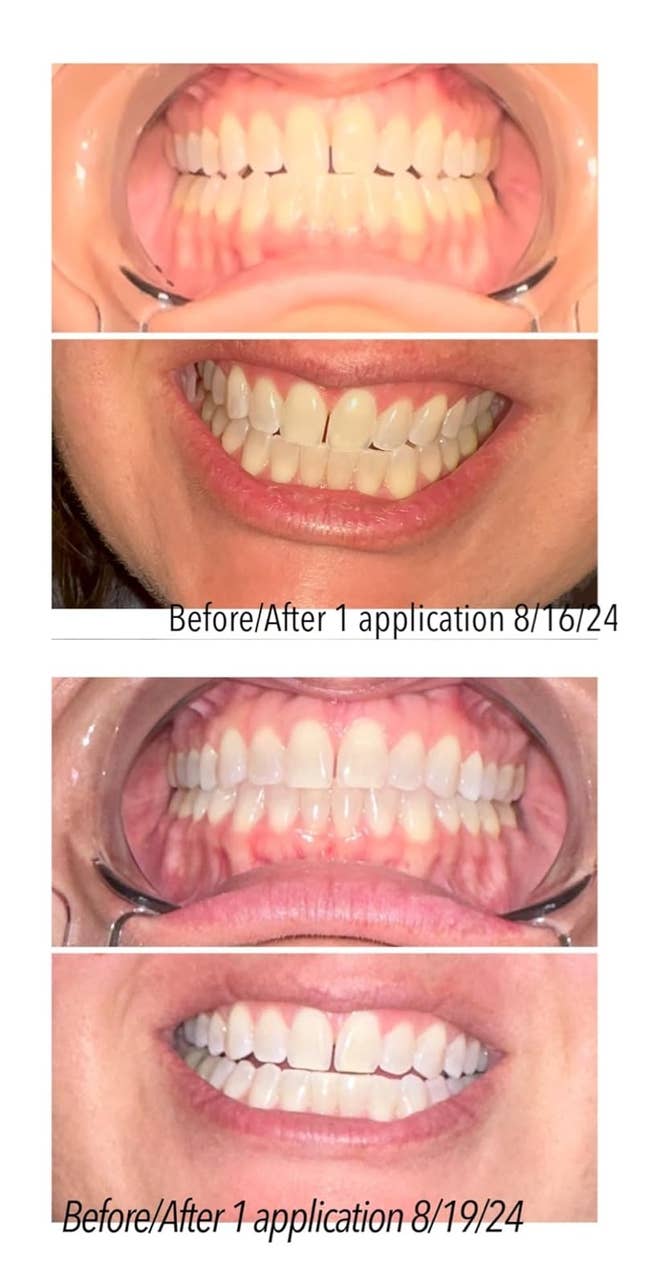 25 Beauty Products With Before-And-After Pictures That’ll Make You An Instant Believer