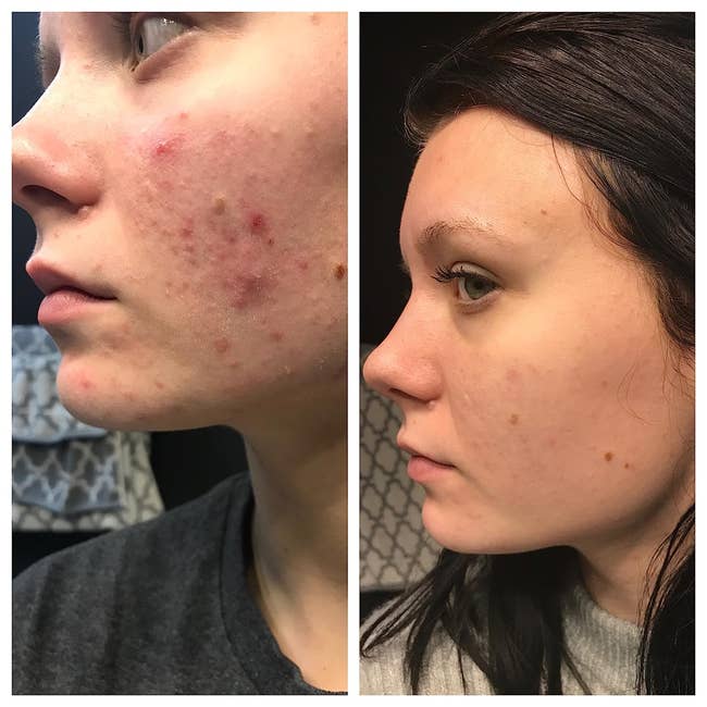 According To Reviewers, These 25 Skincare Products "Work Like Magic"...So, Yeah, You'll Want To Try 'Em