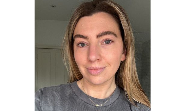 ‘This peptide serum is the latest to go viral for Botox-like effects – I tried it out’