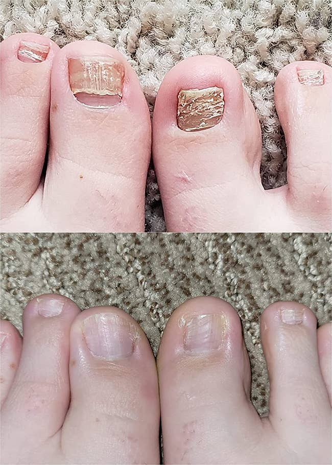 31 Beauty Products That So Many Reviewers Love, You’ll Wanna See What All The Hype Is About