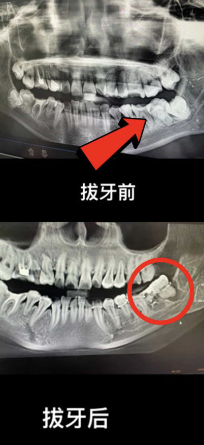 Woman Reportedly Commits Suicide After She Was Left In Agony From Botched Wisdom Tooth Surgery Due To Alleged “Medical Malpractice”