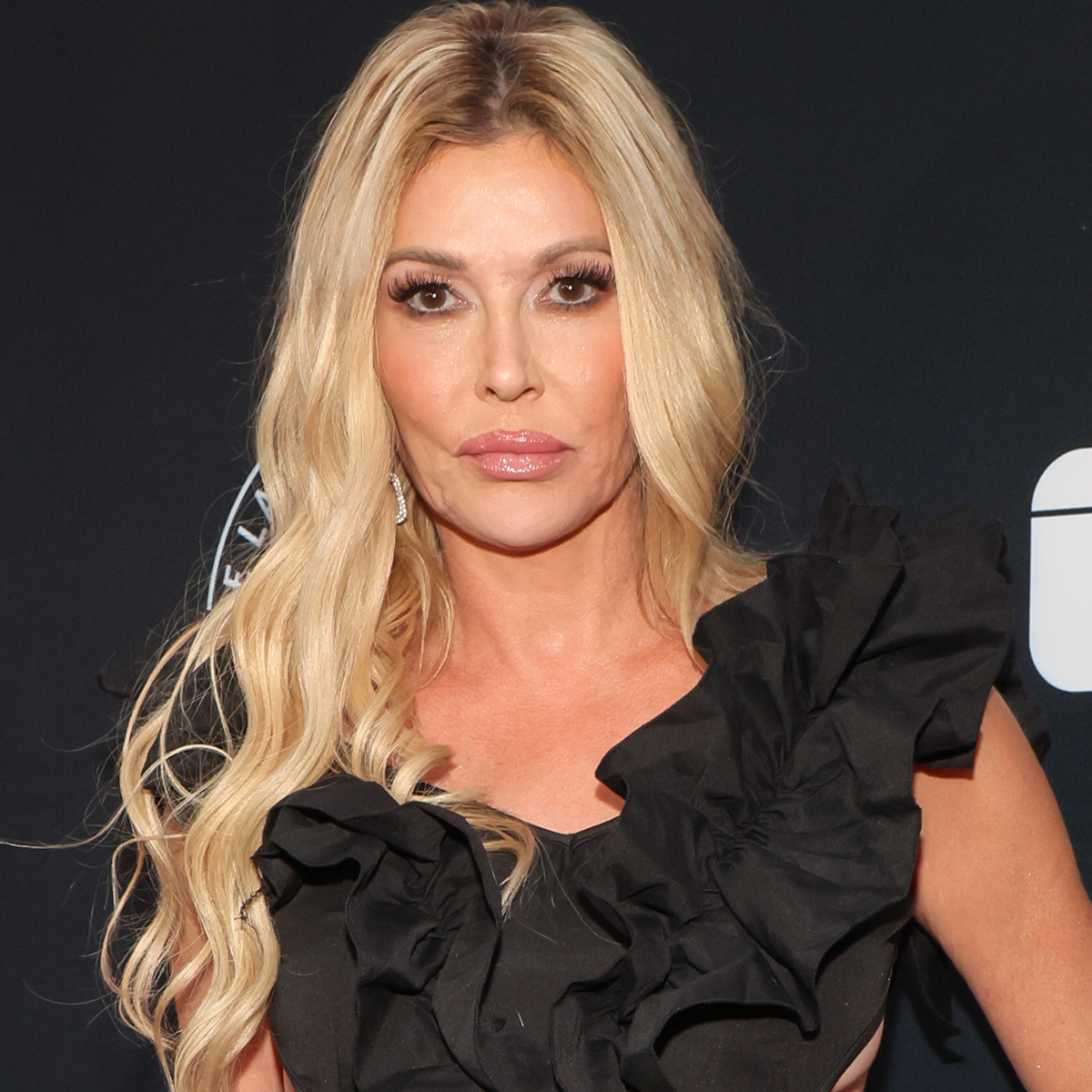 Brandi Glanville Reveals Shocking Amount of Money She's Spent to Treat Mystery "Moving" Facial Parasite