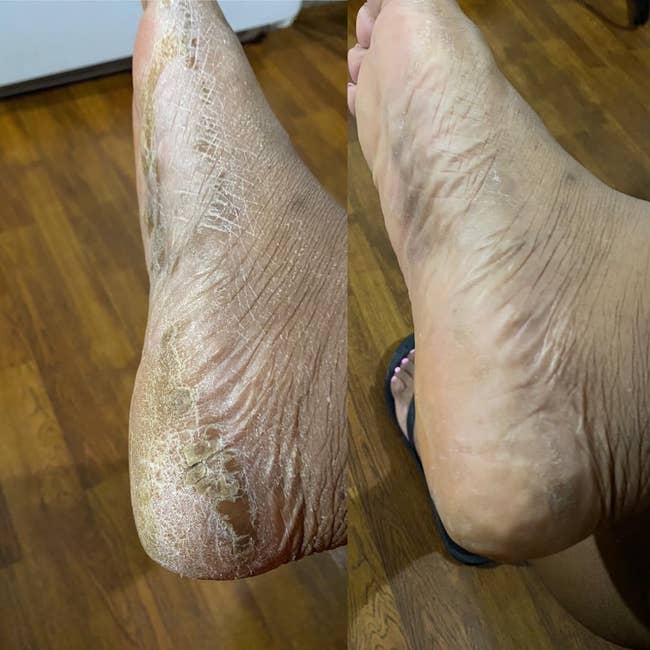 27 Skincare Products That’ll Help Improve At Least One Of Your Concerns — No Magic Wand Required