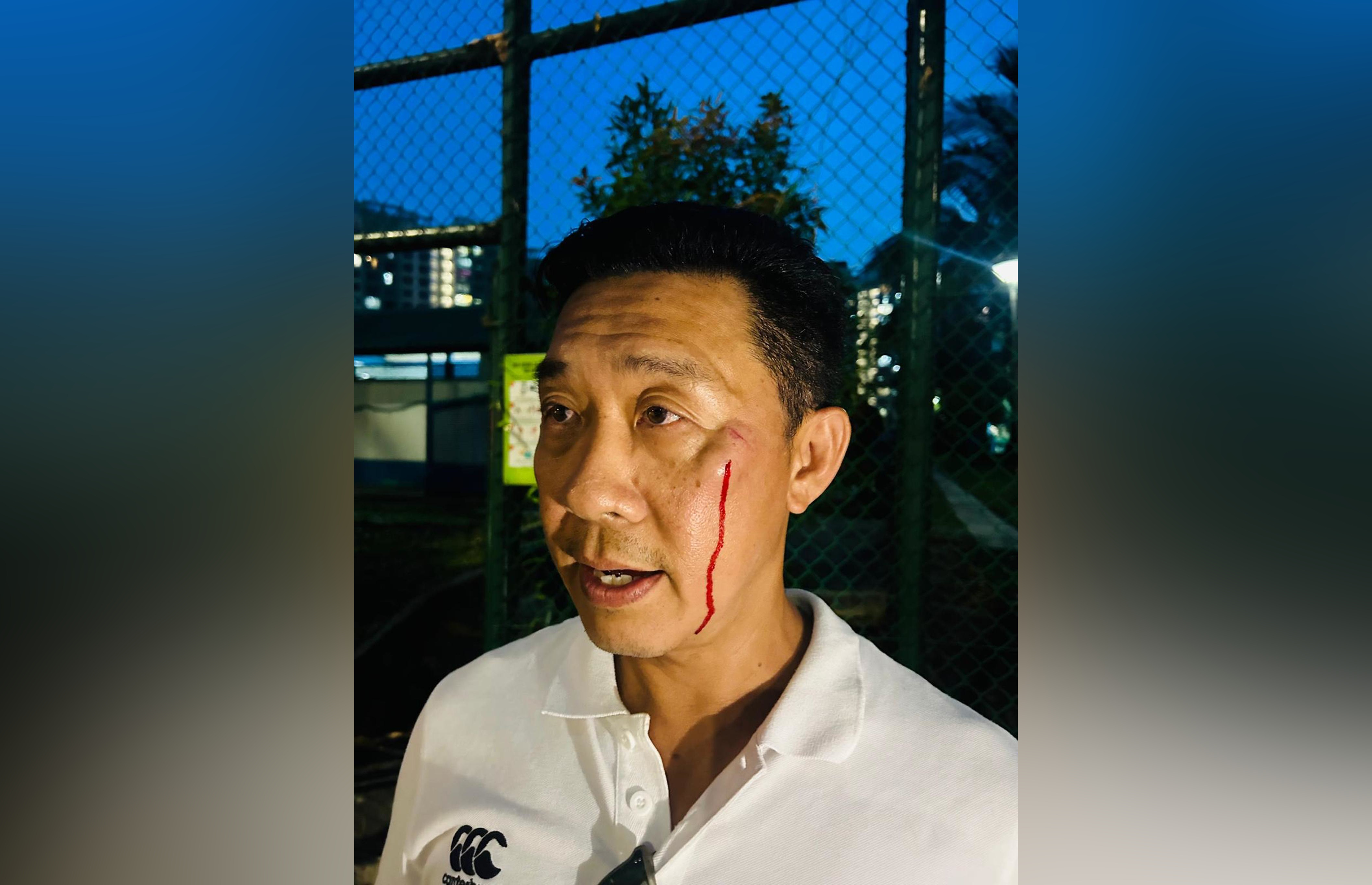 Man arrested for ‘rash act causing hurt’ after  Singapore Youth League match