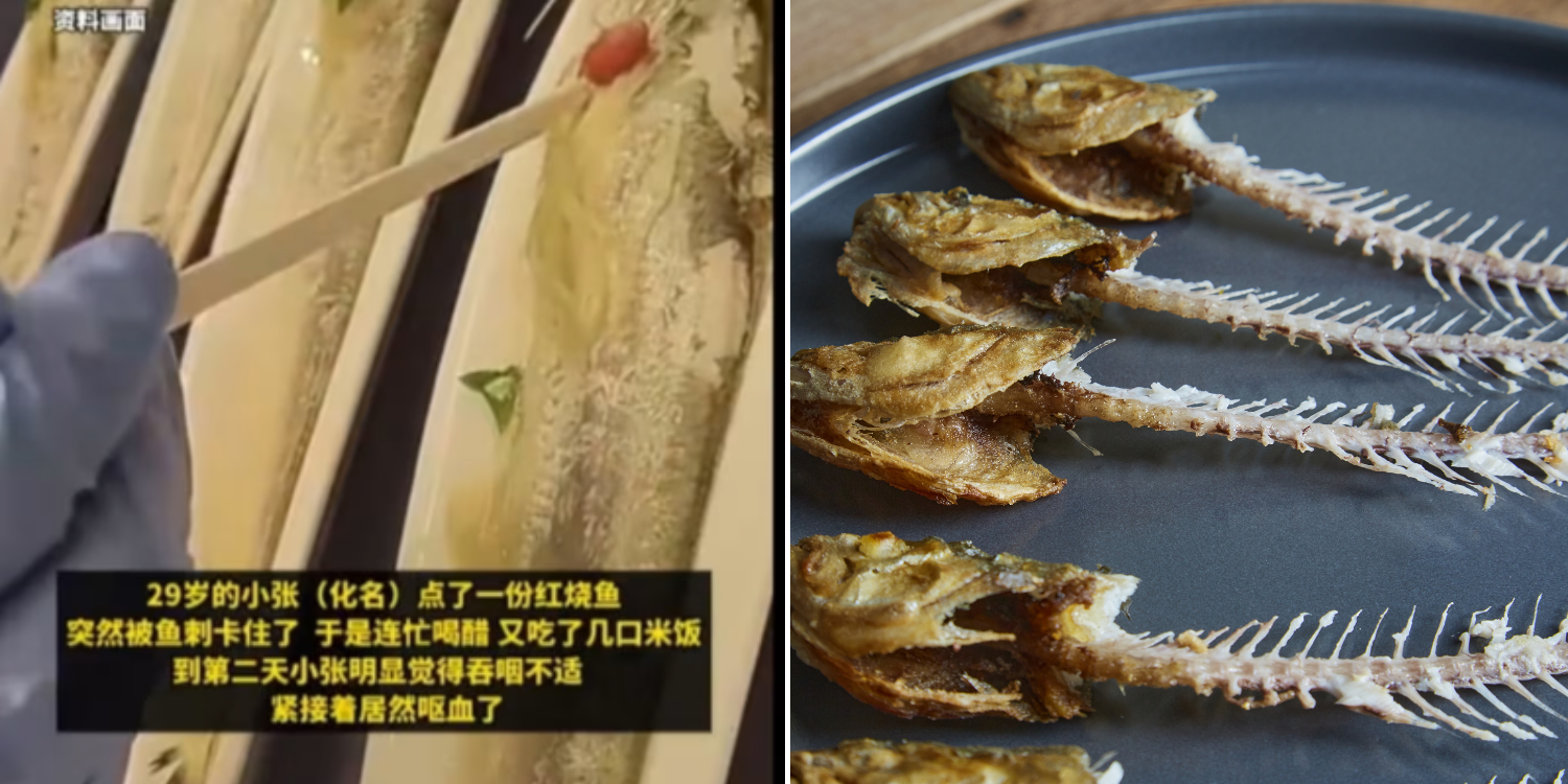 Man in China swallows 5cm fish bone, dies after trying vinegar & rice home remedy