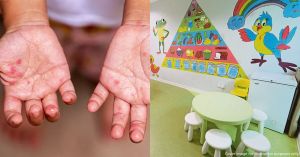 Malaysia Sees 266% Surge In HFMD Cases This Year. These 3 States Are The Worst-Hit