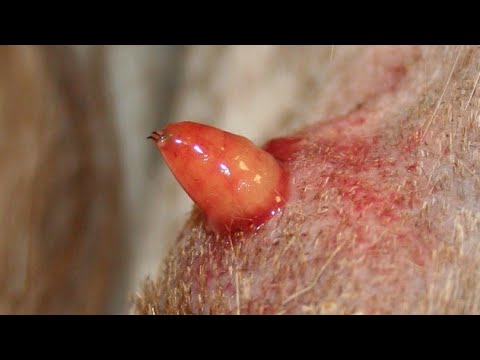 Elimiting An Enormous Cuterebra From Small Dog's Skin #155