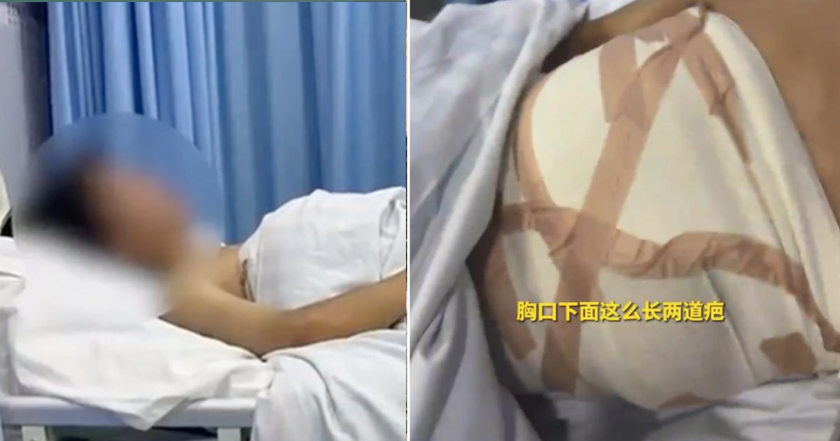 PRC MAN WENT CLINIC FOR JOB BUT TRICKED INTO GETTING A BOOB JOB