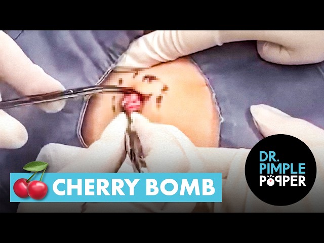 Cherry Bomb 🍒💥