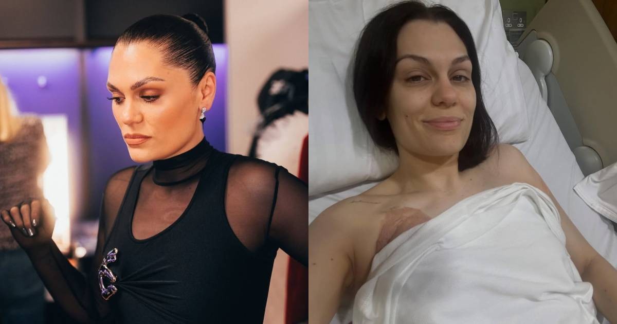 Jessie J undergoes breast cancer surgery