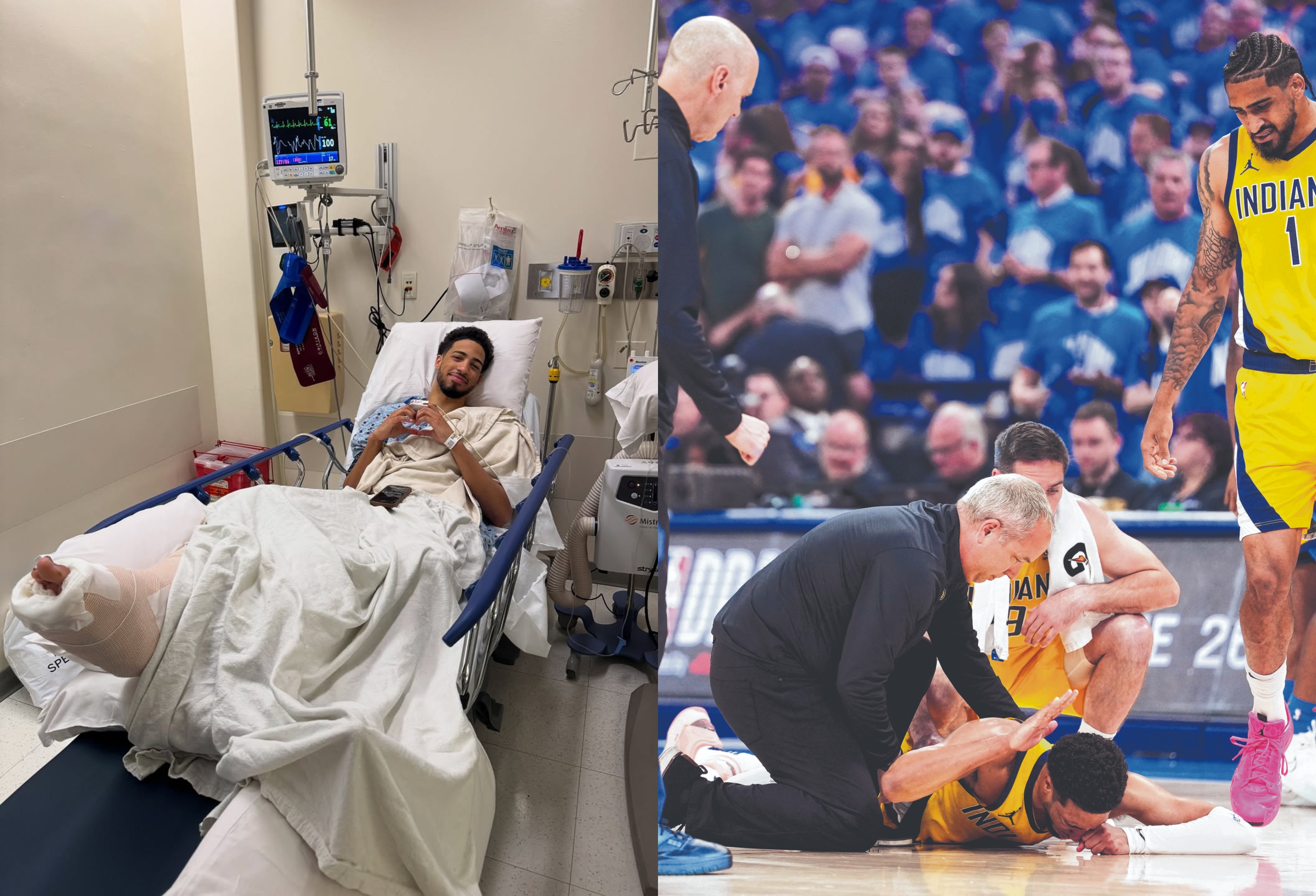 Indiana Pacers’ Tyrese Haliburton says no regrets after Achilles tendon surgery
