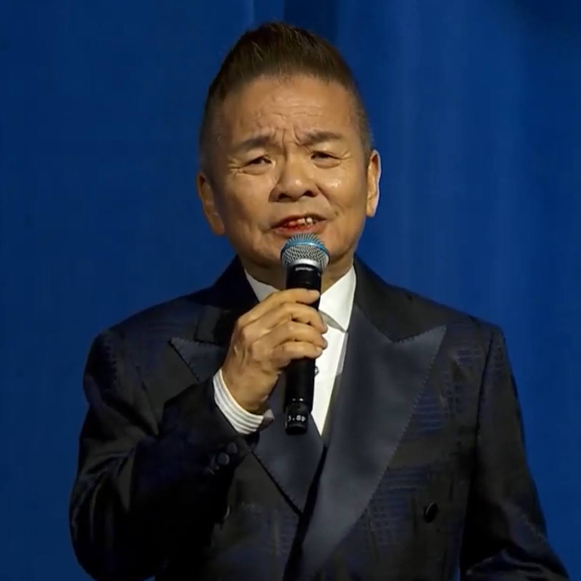 Marcus Chin Was Bleeding In The Mouth During Live Charity Show; He Reveals What Happened