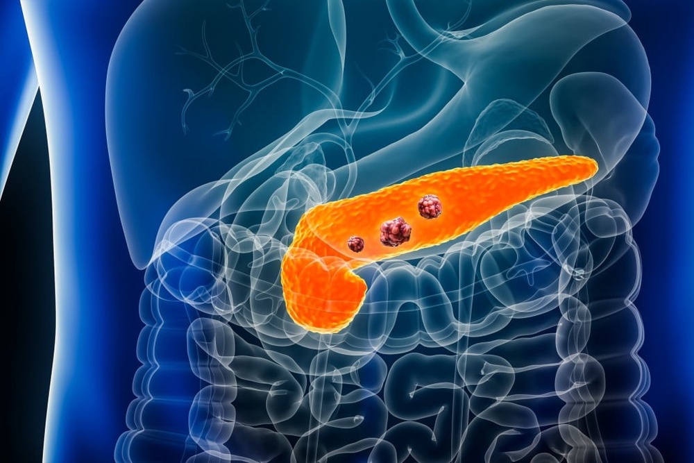 Chinese study uncovers cancer-fighting potential of impotence drugs like Viagra