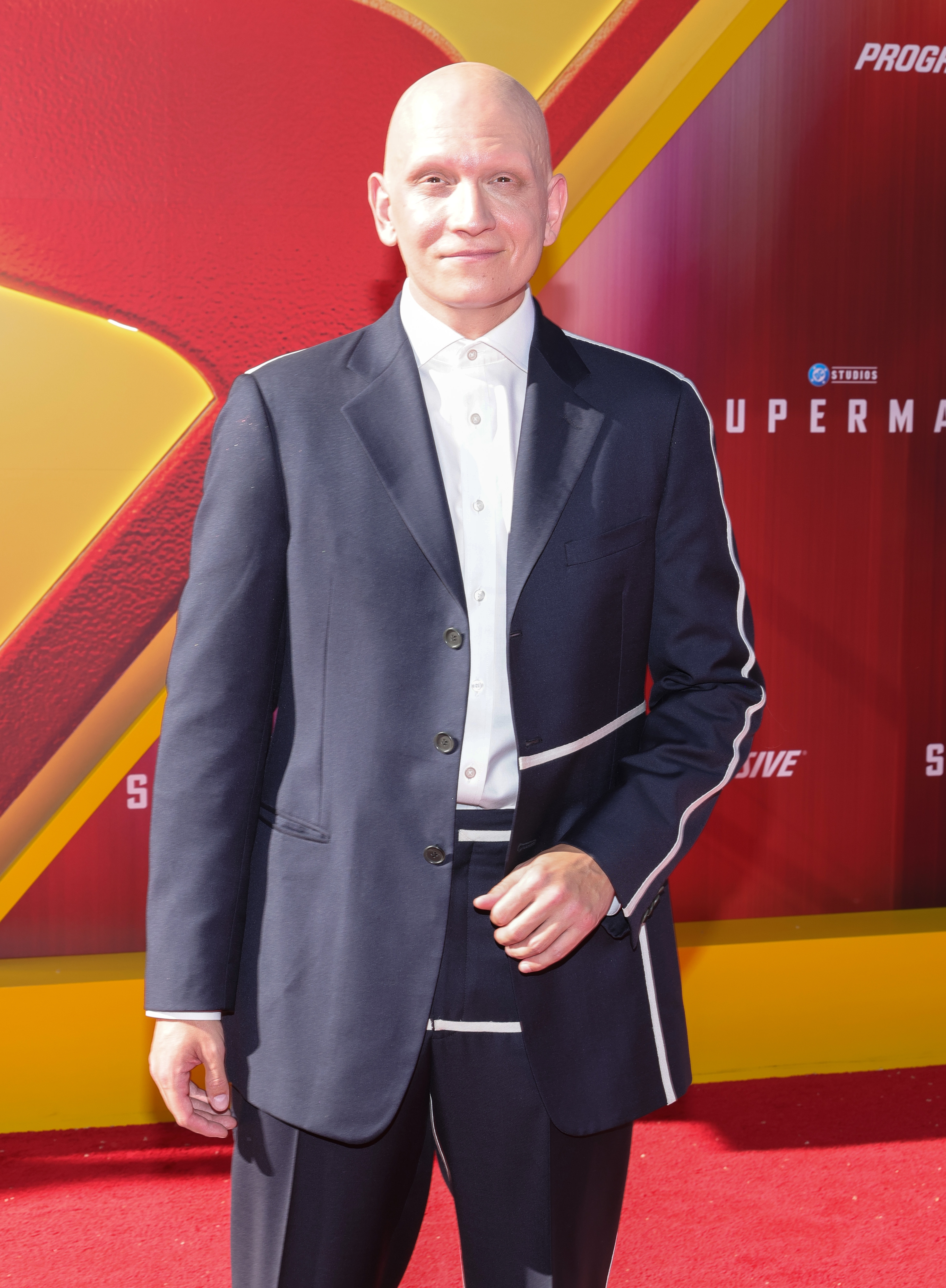 After Suffering Hair Loss From Alopecia, Anthony Carrigan Recalled Being Told To "Get Out" Of Hollywood Because He Was "Not Attractive Anymore"