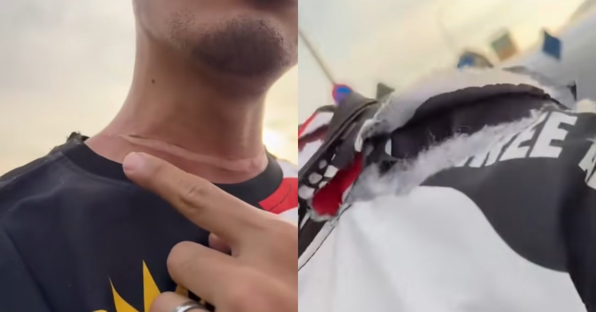 Kite string rips through clothes and bag strap, nearly strangles motorcyclist on KL highway