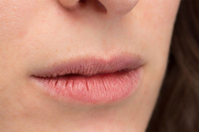 Dry mouth is a warning sign from your pregnant body