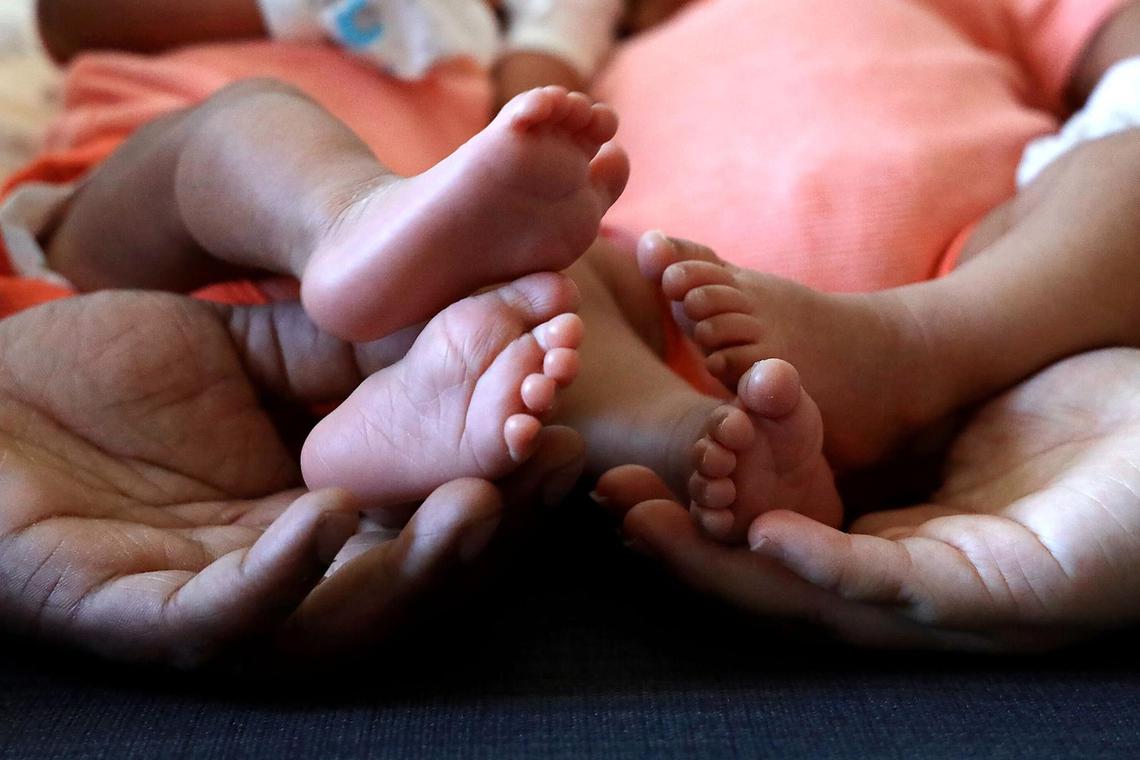 Singapore’s national screening programme tests newborns for metabolic and heritable diseases